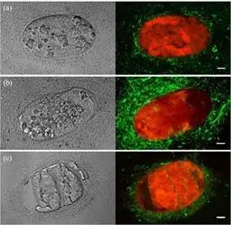 Antagonistic activity of Bacillus Firmus النشاط العدائي لبكتيريا Bacillus Firmus